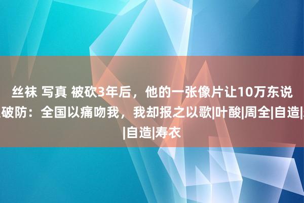 丝袜 写真 被砍3年后，他的一张像片让10万东说念主破防：全国以痛吻我，我却报之以歌|叶酸|周全|自造|寿衣